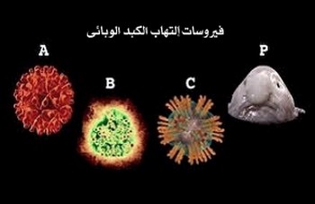 التهاب الكبد الفيروسي Hepatitis