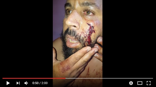 بني ملال.. شرطي يرسل بائع فواكه للمستعجلات بضربه بالأصفاد على وجهه.. (فيديو)